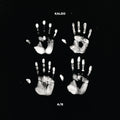 Kaleo - A/B (10th Anniversary Deluxe Edition) (Black & White Vinyl) (New Vinyl)