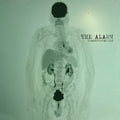 The Alarm - Transformation (Indie Exclusive Green Vinyl) (New Vinyl)