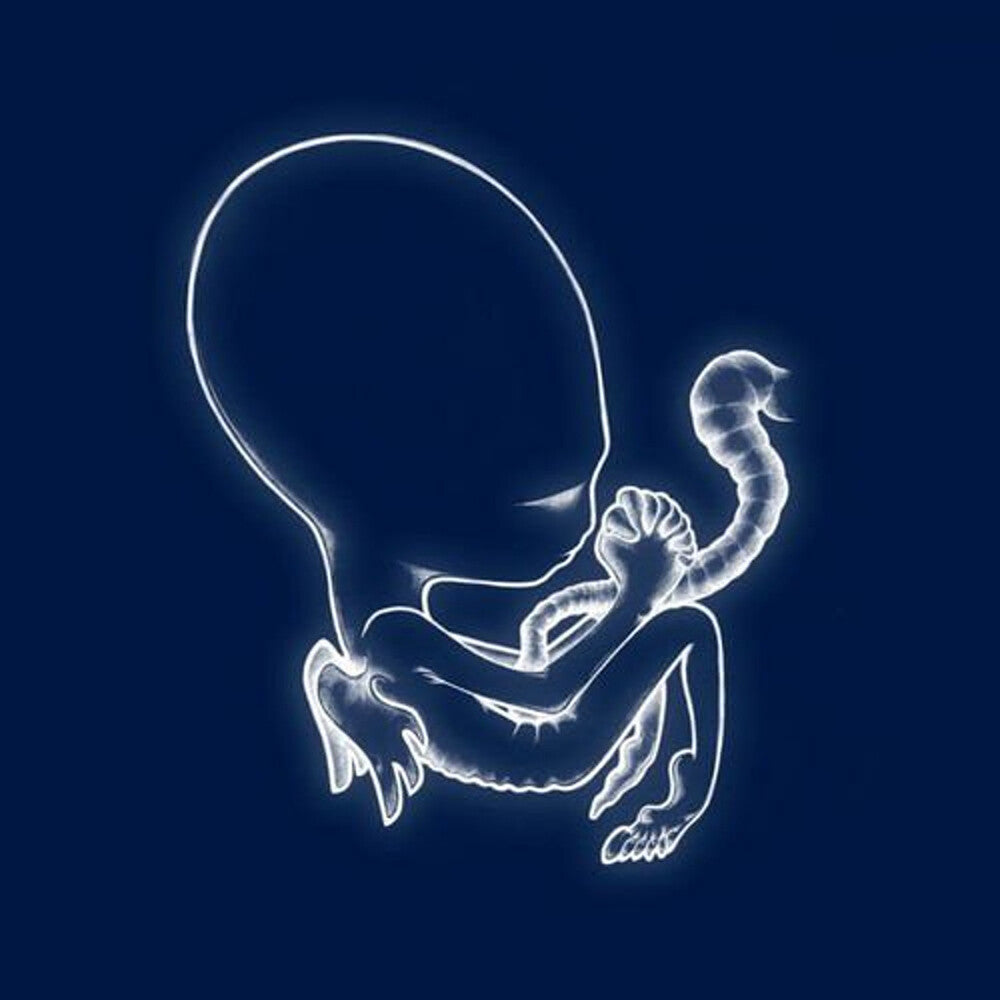 Sigur Ros - Agaetis Byrjun (New Vinyl)