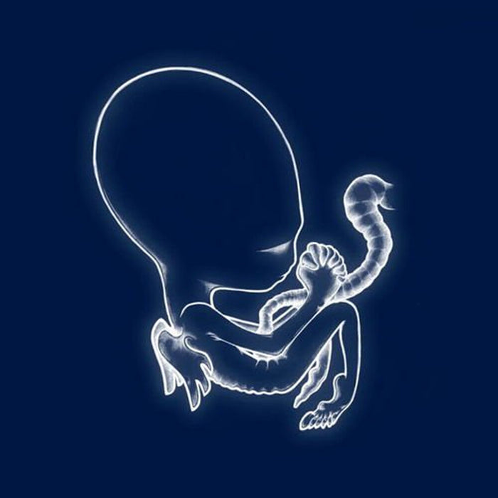 Sigur Ros - Agaetis Byrjun (New Vinyl)
