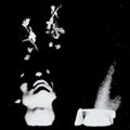 Various - Anxious Color (New Vinyl)